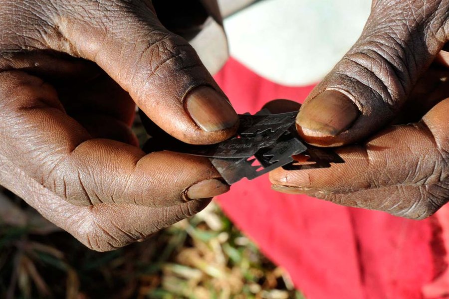 FGM-